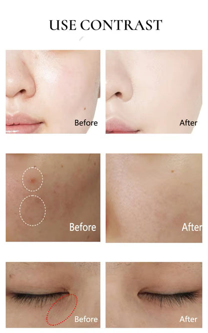 Retinol Miracle Cream